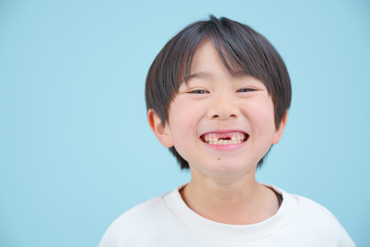 乳歯が抜けた男の子